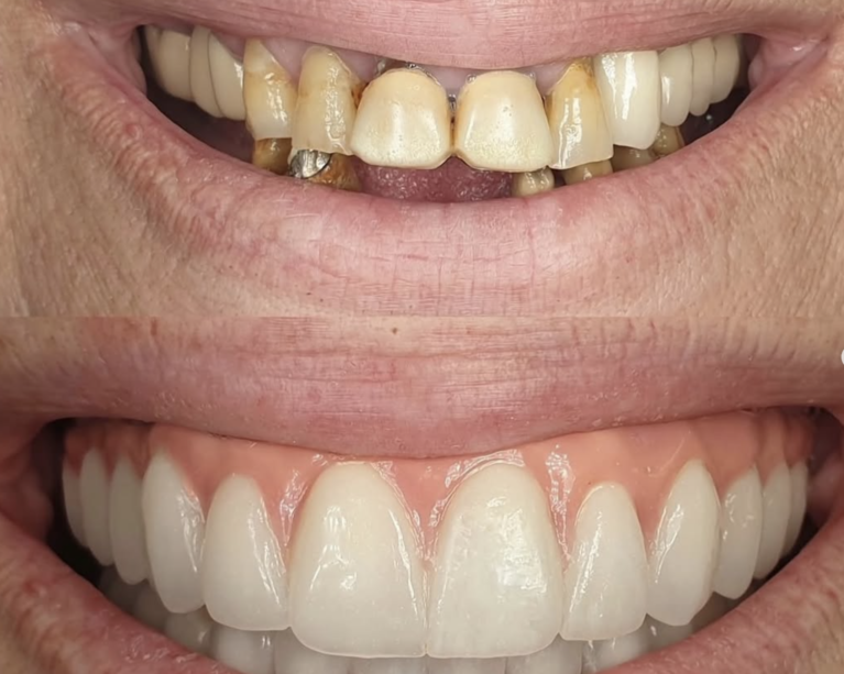 Screenshot 2026-01-24 at 11.22.39