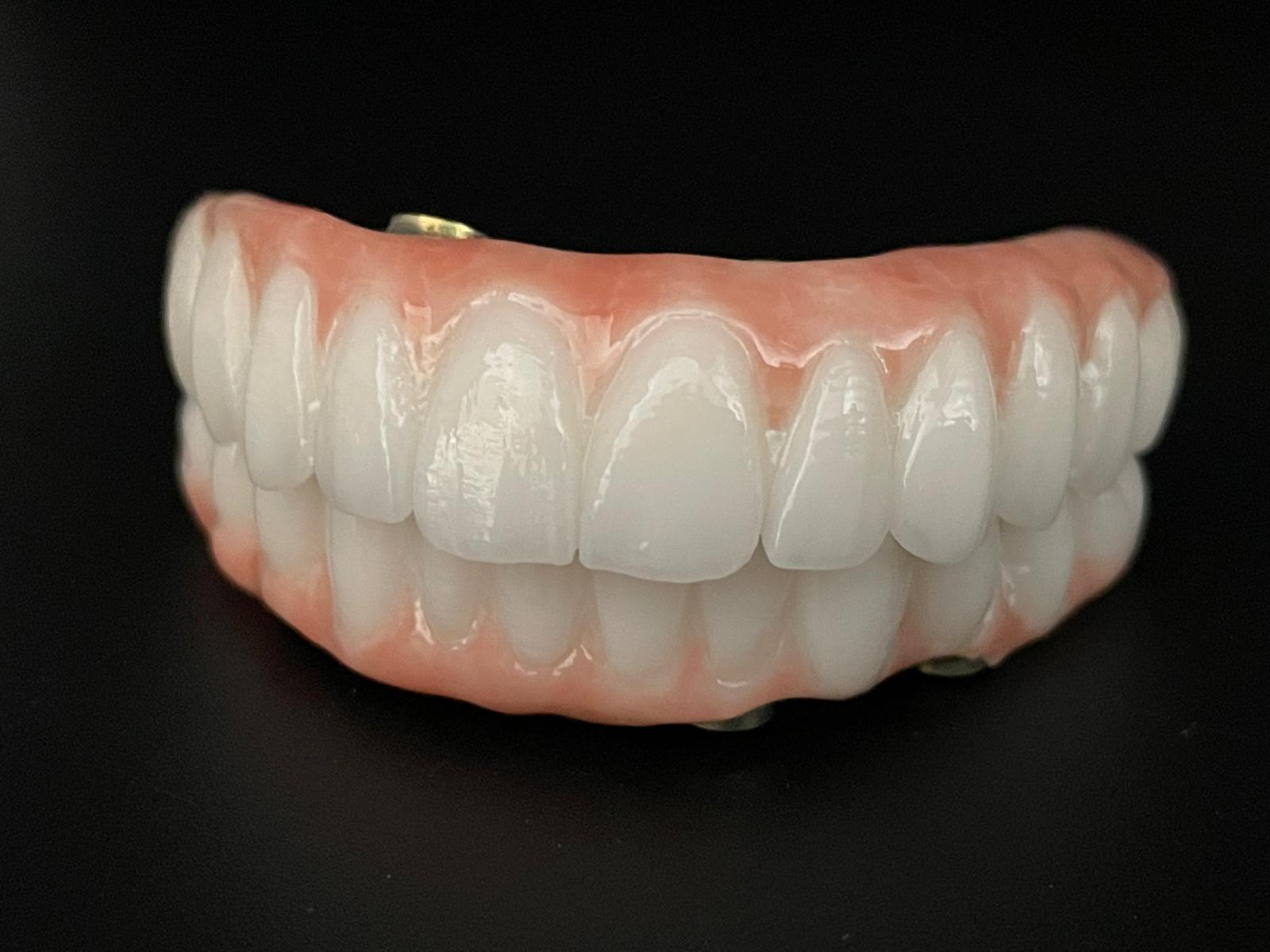 All-on-4/6 – Lucrare protetică finală Titan + Zirconiu Standard