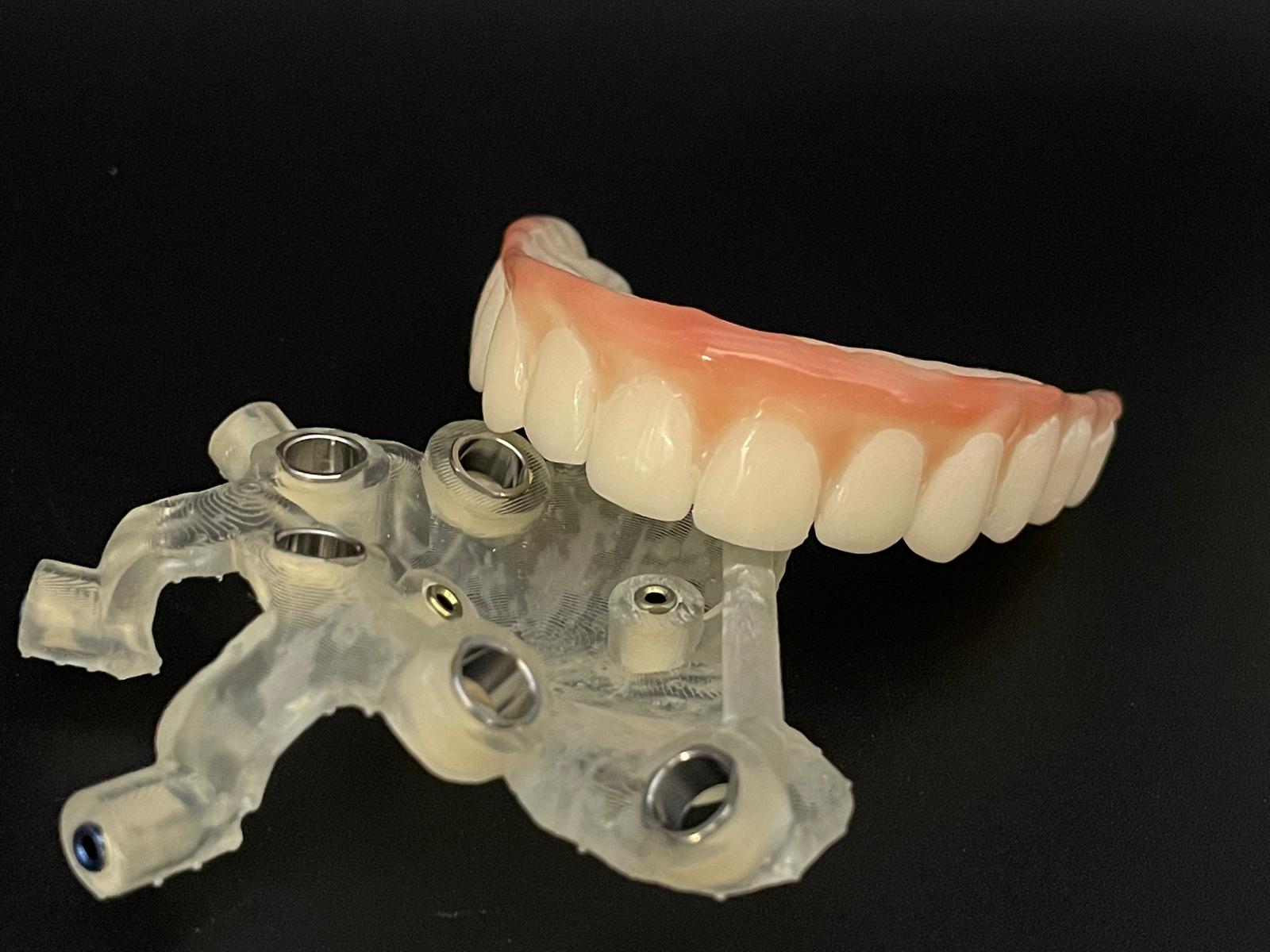 Proteză chirurgicală provizorie preoperatorie