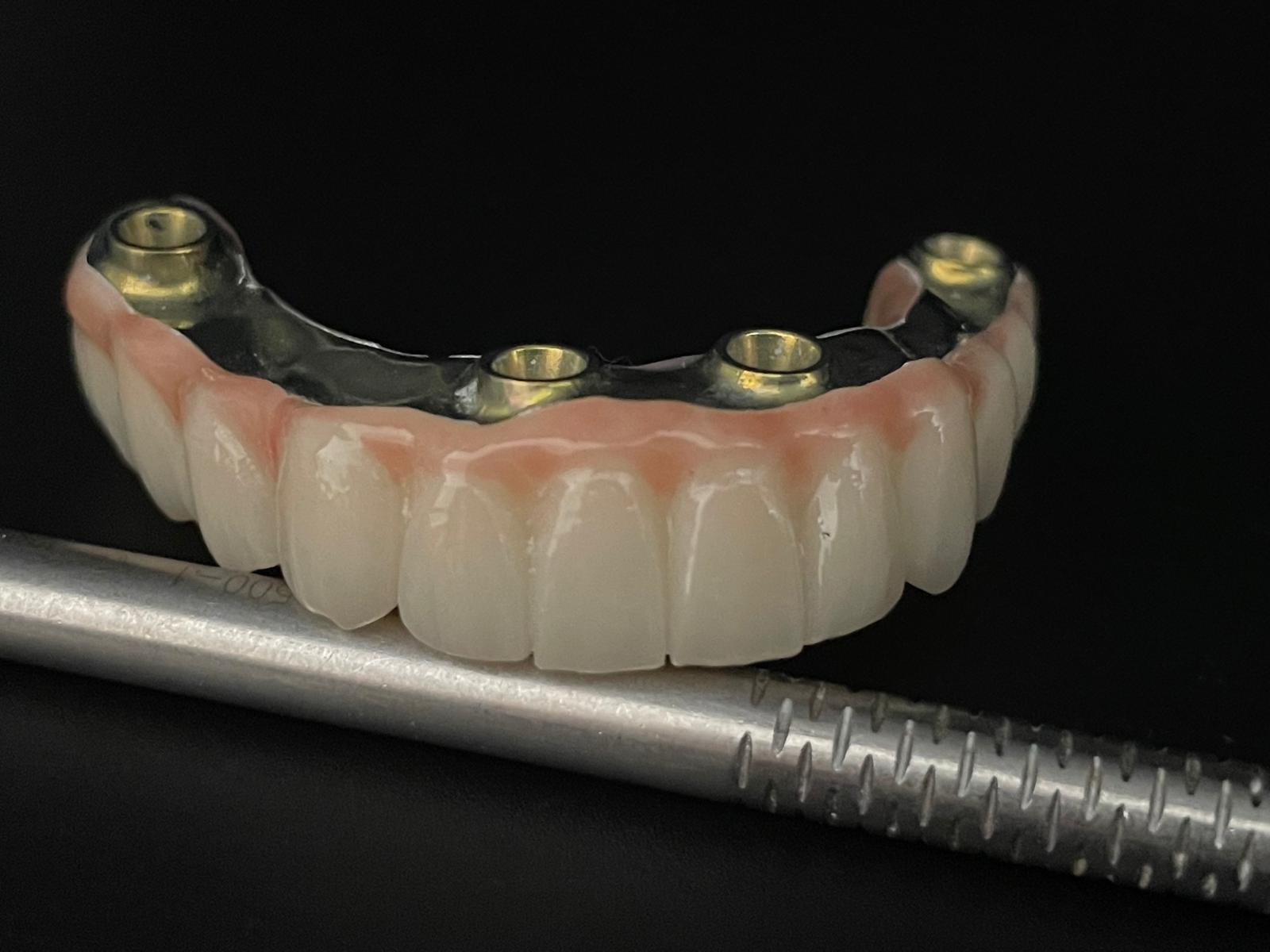 All-on-4/6 – Lucrare protetică finală Titan + Zirconiu Standard - imagine 2