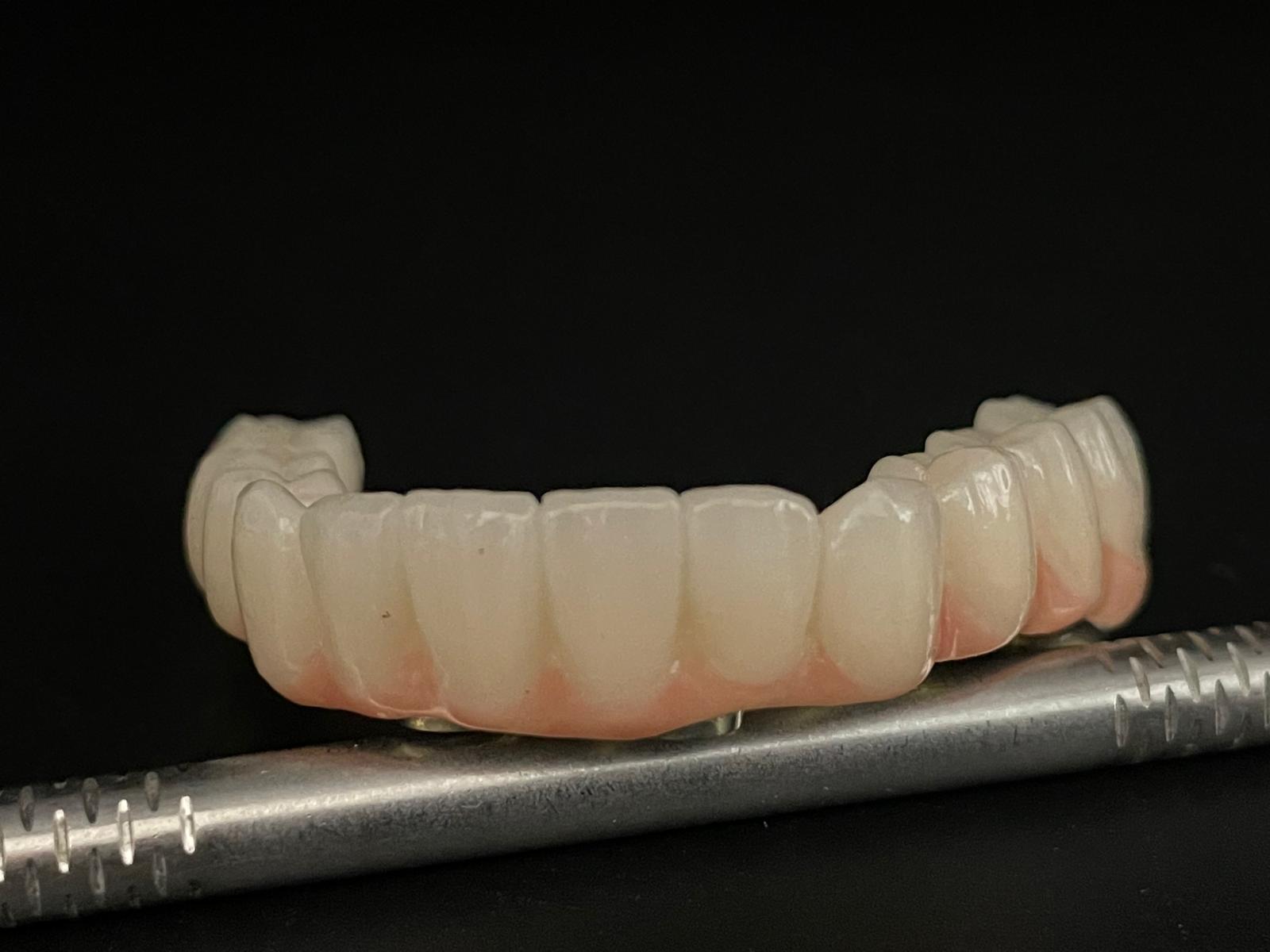 All-on-4/6 – Lucrare protetică finală Titan + Zirconiu Standard - imagine 4