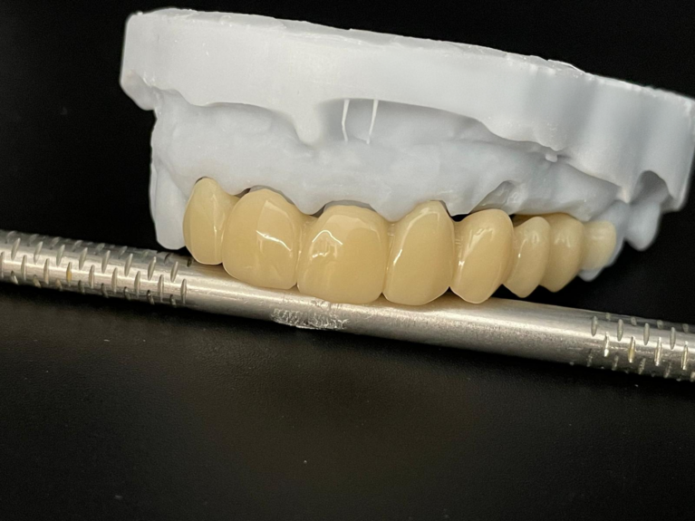 Coroană PMMA Standard