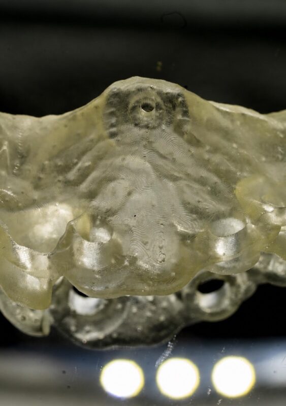 În cazurile implantare complexe, laboratorul trebuie implicat înainte ca deciziile chirurgicale să devină definitive.