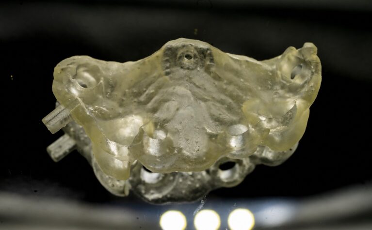 În cazurile implantare complexe, laboratorul trebuie implicat înainte ca deciziile chirurgicale să devină definitive.