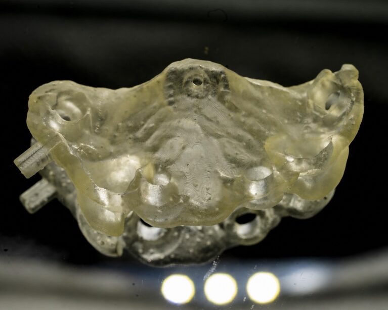 În cazurile implantare complexe, laboratorul trebuie implicat înainte ca deciziile chirurgicale să devină definitive.