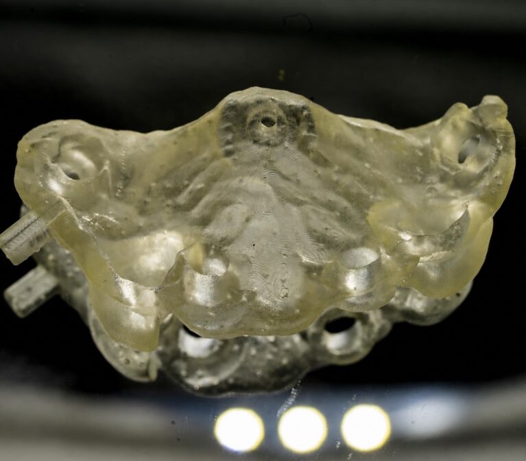 În cazurile implantare complexe, laboratorul trebuie implicat înainte ca deciziile chirurgicale să devină definitive.