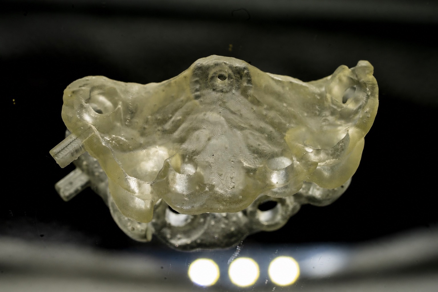 În cazurile implantare complexe, laboratorul trebuie implicat înainte ca deciziile chirurgicale să devină definitive.