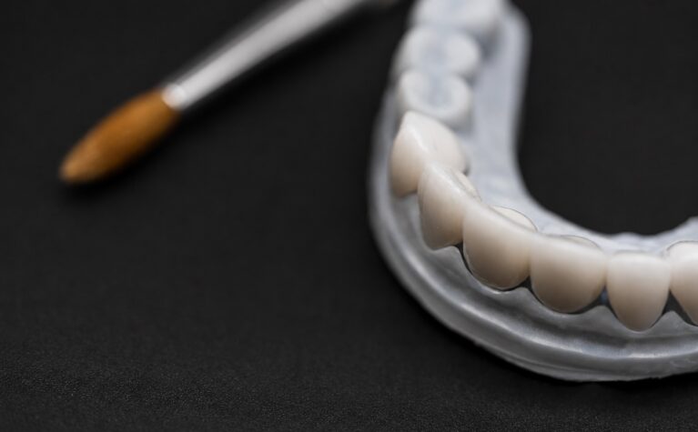 Prețul lucrării se vede pe factură. Costul unei refaceri se împrăștie în programări, timp clinic și încrederea pacientului.