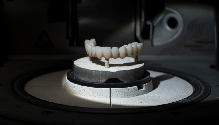 Restaurare All-on-X din zirconiu finisată, prezentată în laborator