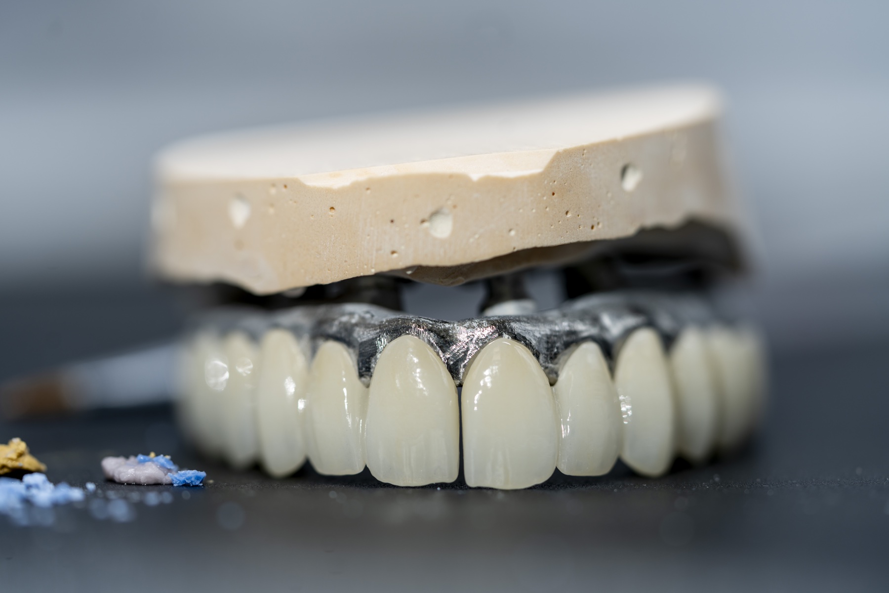 Restaurare metalo-ceramică extinsă și infrastructura sa pe model de laborator