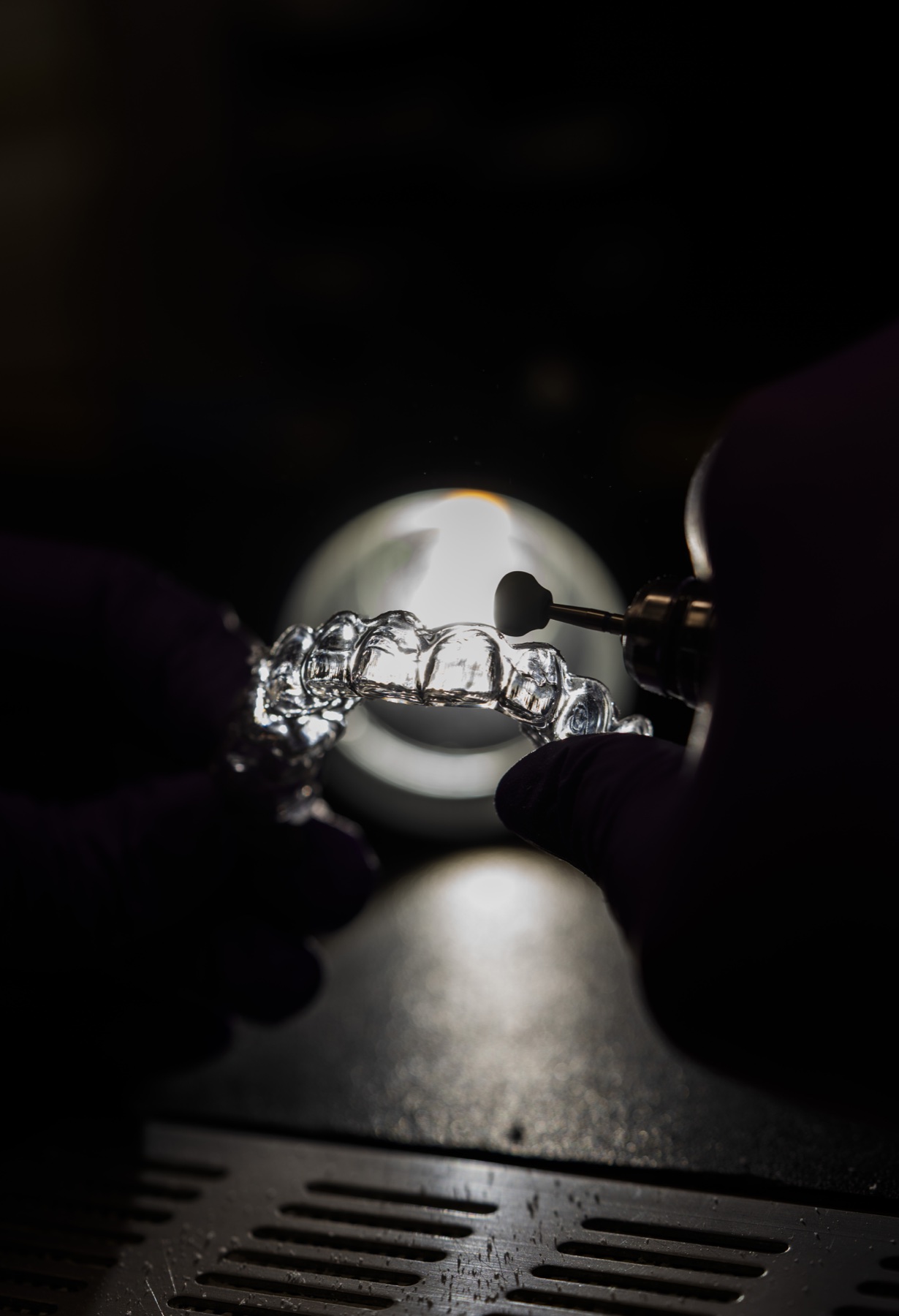 Alignere transparente și modele dentare pregătite în laborator
