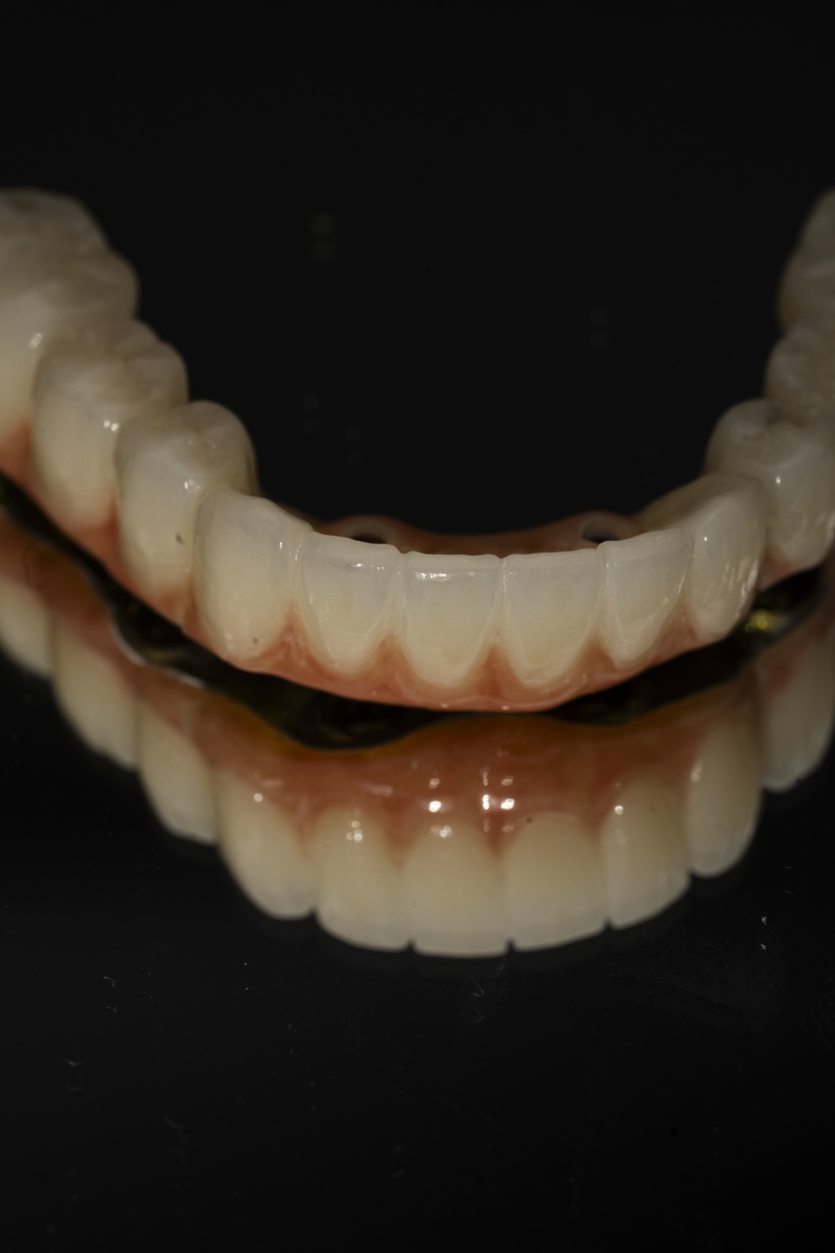 Restaurare protetică bimaxilară pe infrastructură de titan și zirconiu