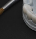 Restaurări din zirconiu analizate pentru culoare și integrare estetică