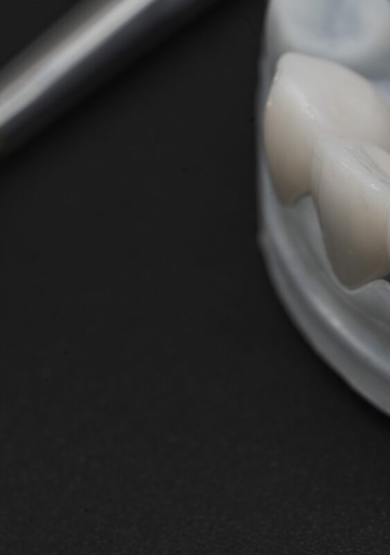 Restaurări din zirconiu analizate pentru culoare și integrare estetică