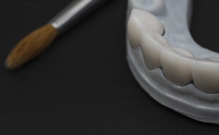 Restaurări din zirconiu analizate pentru culoare și integrare estetică