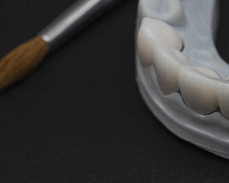 Restaurări din zirconiu analizate pentru culoare și integrare estetică
