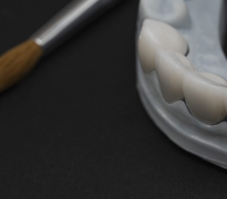 Restaurări din zirconiu analizate pentru culoare și integrare estetică