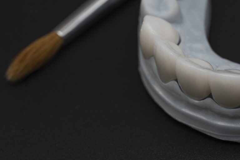 Restaurări din zirconiu analizate pentru culoare și integrare estetică